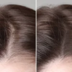 Hair Growth Cycle Explained