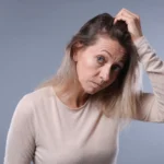 Stress & Hair Loss